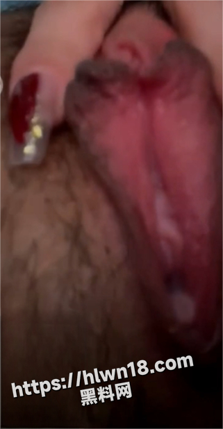 321X618