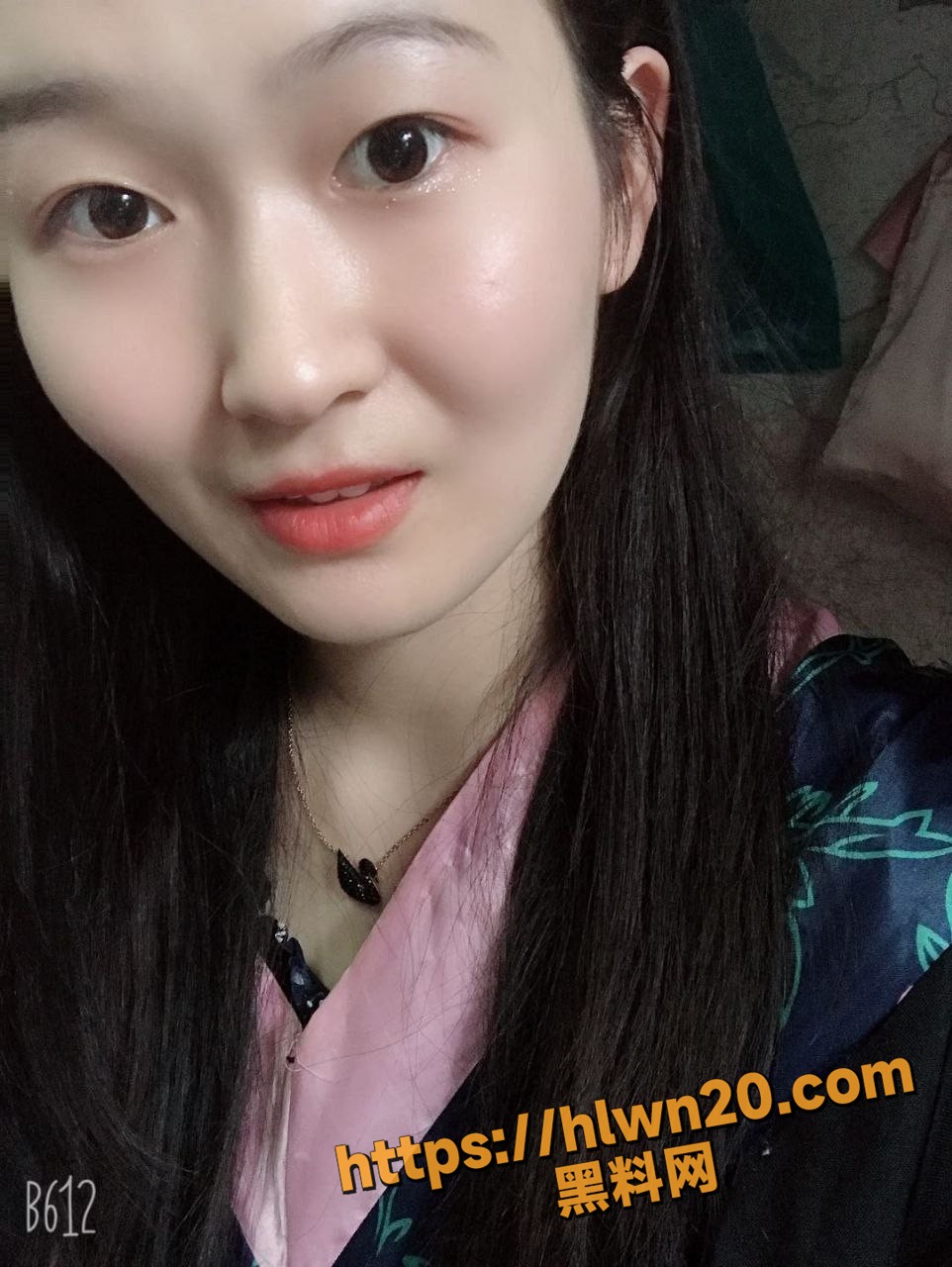 962X1280