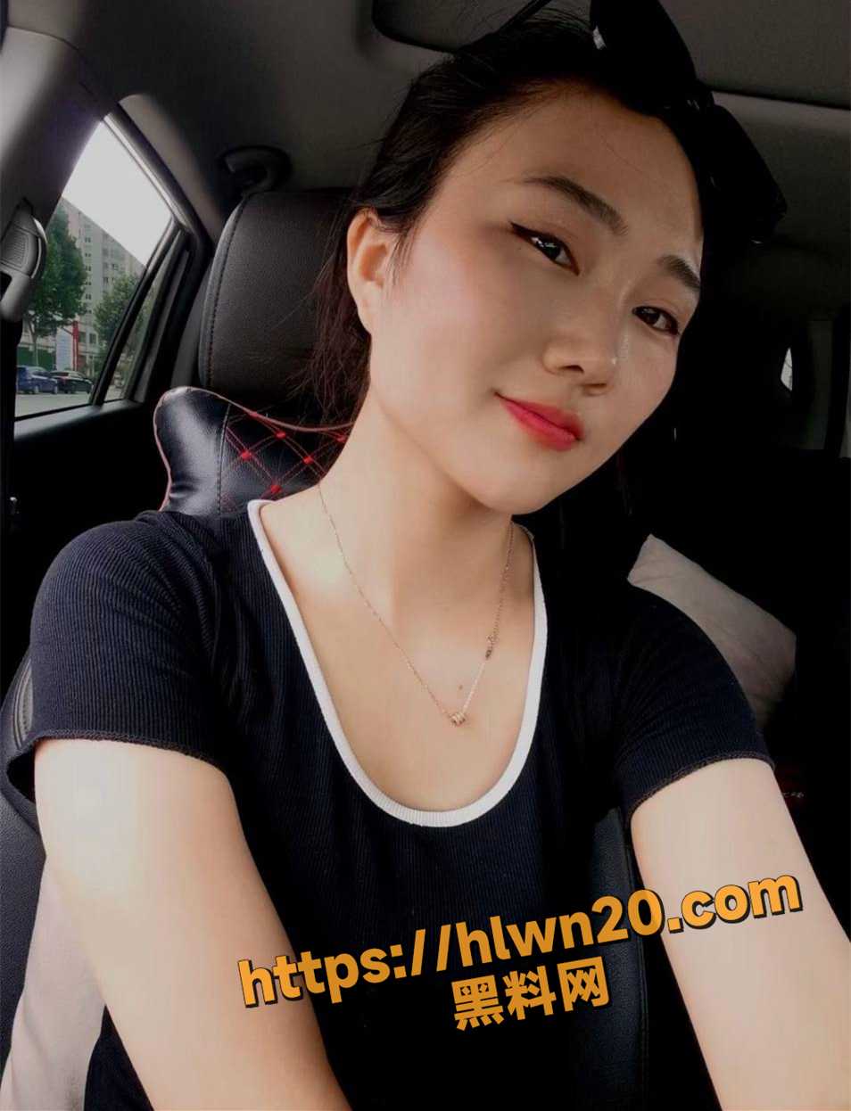 954X1246