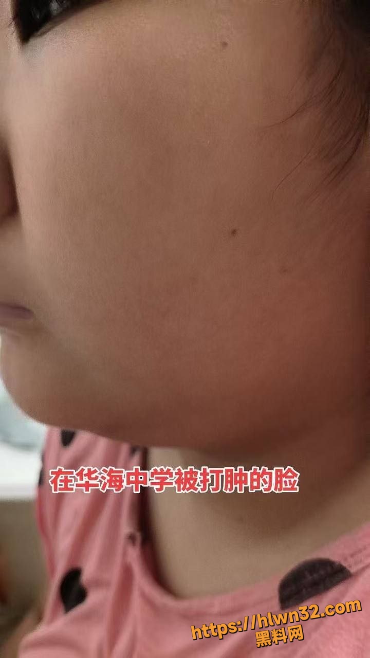 720X1280